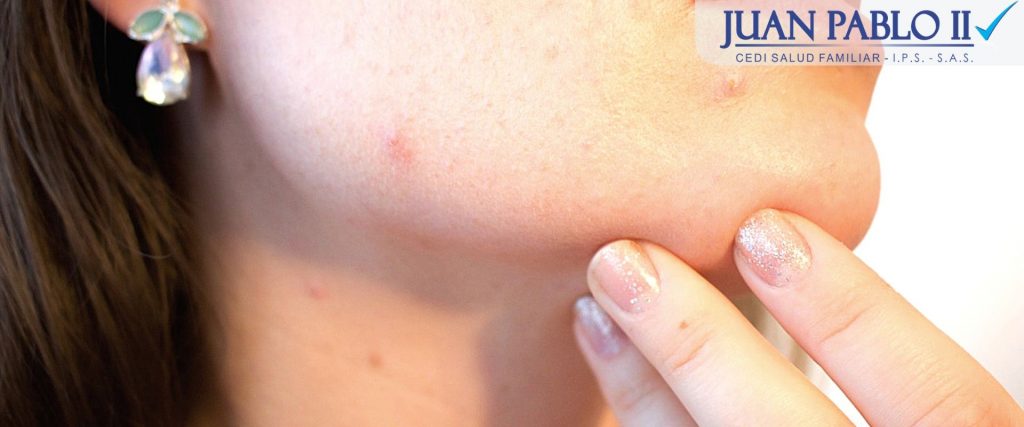 Dermatología - IPS Juan Pablo II